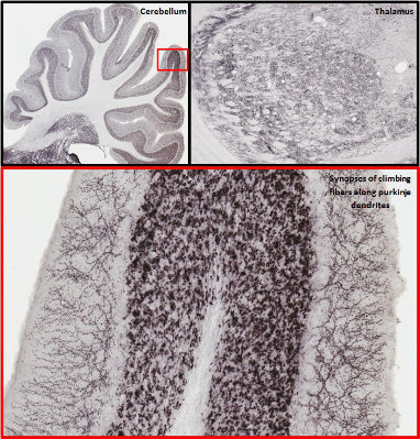 Adult rat cerebellum and thalamus immunohistochemistry.
