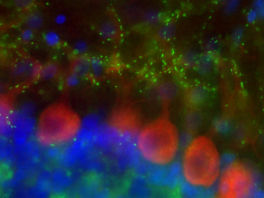 Immunofluorescence staining of adult rat cerebellum with N29/29 (green), N326D/2 (red) and Hoechst nuclear stain (blue).
