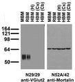 Immunoblot versus crude brain membranes from adult mouse (MBM), rat (RBM) and human hippocampus [HBM(H)], cerebral cortex [HBM(Cx)] and cerebellum [HBM(Cb)] probed with N29/29 (left) and N52A/42 (right) TC supe.