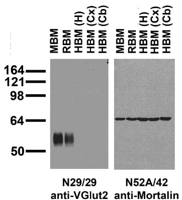 Immunoblot versus crude brain membranes from adult mouse (MBM), rat (RBM) and human hippocampus [HBM(H)], cerebral cortex [HBM(Cx)] and cerebellum [HBM(Cb)] probed with N29/29 (left) and N52A/42 (right) TC supe.