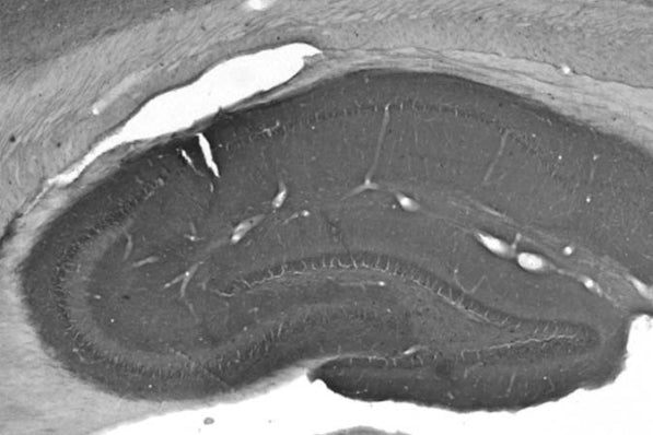 Adult rat hippocampus immunohistochemistry.