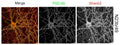 Cultured rat hippocampal neuron immunofluorescence: N23B/49 (Pan-Shank) = red, rabbit anti-PSD-95 = green, merge = yellow (bottom right). Image courtesy of Dr. Albert Hung, Picower Institute, MIT.