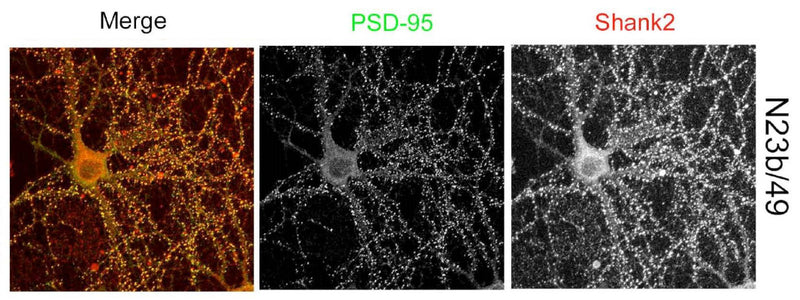 Cultured rat hippocampal neuron immunofluorescence: N23B/49 (Pan-Shank) = red, rabbit anti-PSD-95 = green, merge = yellow (bottom right). Image courtesy of Dr. Albert Hung, Picower Institute, MIT.