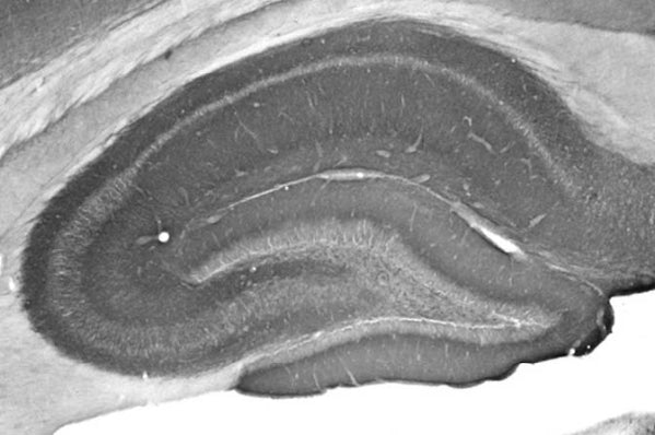 Adult rat hippocampus immunohistochemistry.
