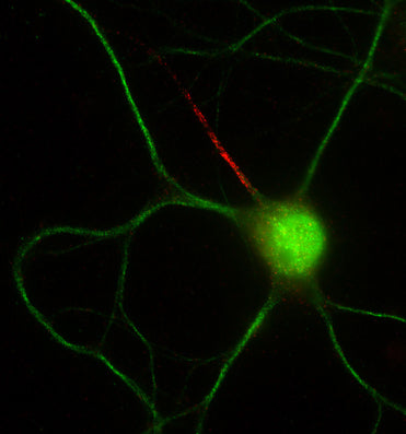 Double immunofluorescence staining of cultured rat hippocampal neurons with N56/21 (red) and MAP2 (green). Images courtesy of David Ornitz (Washington University SOM).