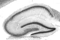 Adult rat hippocampus immunohistochemistry.