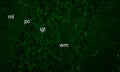 Knockout mice. ml: molecular layer; pc: Purkinje cell layer; igl: internal granule cell layer; wm: white matter.