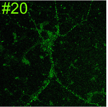Cultured rat hippocampal neuron immunofluorescence. Image courtesy of Anthone Dunah (Harvard) and Morgan Sheng (MIT).