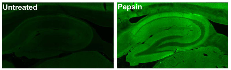 Adult rat hippocampus immunofluorescence under standard protocol (left) and with antigen retrieval via pepsin pretreatment (right).