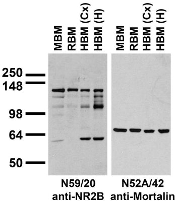 Immunoblots on brain membranes prepared from whole rat (RBM) and mouse (MBM) brain, and from human cerebral cortex [HBM(Cx)] and hippocampus [HBM(H)] probed with N59/20 (left) or N52A/42 (right) TC supe.
