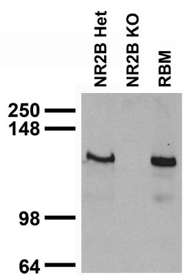 Immunoblot against rat brain membranes (RBM) and neuronal lysates from NR2B knockout (KO) and heterozygote (Het) mice. Samples courtesy of Ben Hall and Anirvan Ghosh (UCSD).