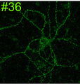 Cultured rat hippocampal neuron immunofluorescence. Image courtesy of Anthone Dunah (Harvard) and Morgan Sheng (MIT).