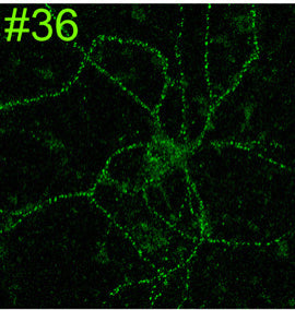 Cultured rat hippocampal neuron immunofluorescence. Image courtesy of Anthone Dunah (Harvard) and Morgan Sheng (MIT).