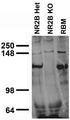Immunoblot against rat brain membranes (RBM) and neuronal lysates from NR2B knockout (KO) and heterozygote (Het) mice. Samples courtesy of Ben Hall and Anirvan Ghosh (UCSD).