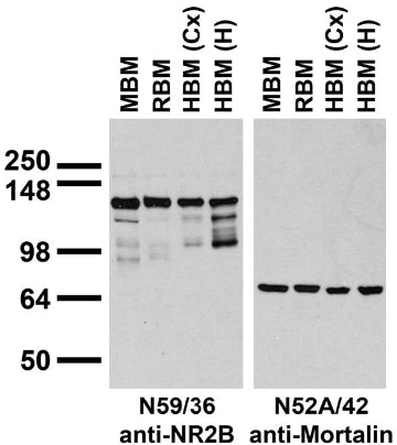 Immunoblots on brain membranes prepared from whole rat (RBM) and mouse (MBM) brain, and from human cerebral cortex [HBM(Cx)] and hippocampus [HBM(H)].