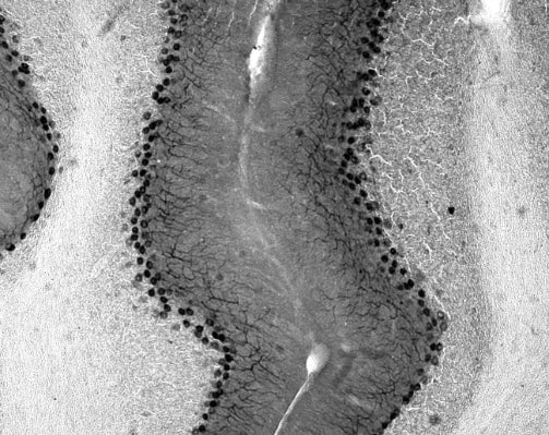Adult rat cerebellar immunohistochemistry.
