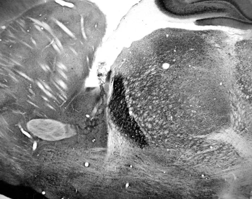 Adult rat reticular thalamic nucleus immunohistochemistry.