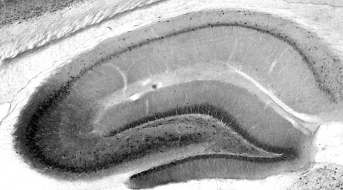 Adult rat hippocampal immunohistochemistry.