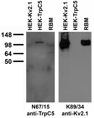 Adult rat brain membrane (RBM) and transfected cell immunoblot: extracts of RBM and HEK-293 cells transiently transfected with TrpC5 and Kv2.1 plasmids and probed with N67/15 (left) or K89/34 (right) TC supe.