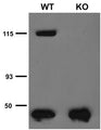 Immunoprecipitation analysis of TRPC5 protein in brain microsomes extracted from wild-type (WT) and TRPC5 knockout (KO) littermates. Courtesy of Dr. David Clapham (HHMI/Harvard Medical School).