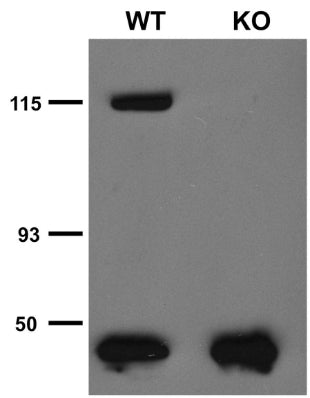 Immunoprecipitation analysis of TRPC5 protein in brain microsomes extracted from wild-type (WT) and TRPC5 knockout (KO) littermates. Courtesy of Dr. David Clapham (HHMI/Harvard Medical School).