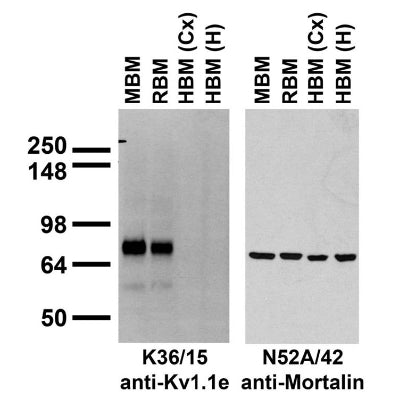 Immunoblot versus crude brain membranes from adult mouse (MBM), rat (RBM) and human cerebral cortex [HBM(Cx)] and hippocampus [HBM(H)] probed with K36/15 (left) or N52A/42 (right) TC supe.