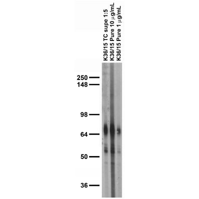 Adult brain membrane immunoblot.