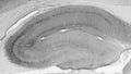 Adult rat hippocampus immunohistochemistry.
