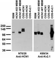 Adult rat and mouse brain membrane (RBM and MBM, respectively) and transfected cell immunoblot: extracts of RBM, HCN1-KO and -WT MBM and COS-1 cells transfected with GFP-HCN1, GFP-HCN2 or Kv2.1 plasmids and probed with N70/28 (left panel) or K89/34 TC supe (right panel).
