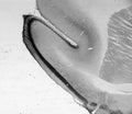 Adult rat hippocampus immunohistochemistry.
