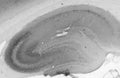 Adult rat hippocampus immunohistochemistry.