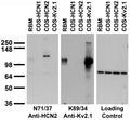 Adult rat brain membrane (RBM) and transfected cell immunoblot: extracts of RBM and of COS-1 cells transfected with GFP- HCN1, GFP-HCN2 or Kv2.1 plasmids and probed with N71/37 (left), K89/34 (middle) or a control (right) TC supe.