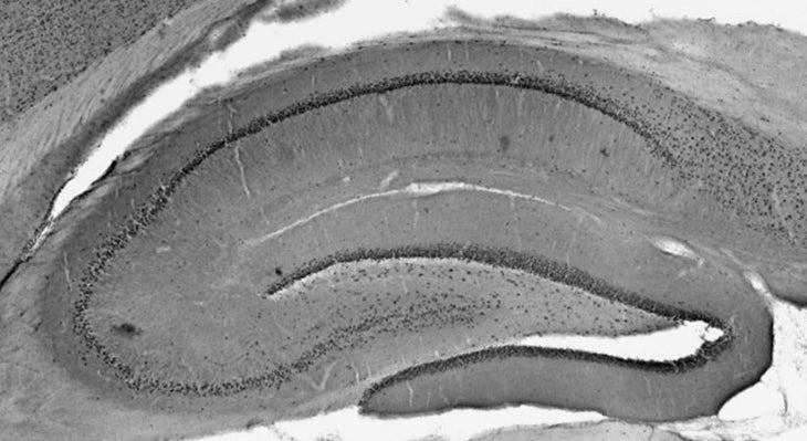 Adult rat hippocampus immunohistochemistry.