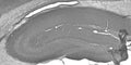 Adult rat hippocampus immunohistochemistry.