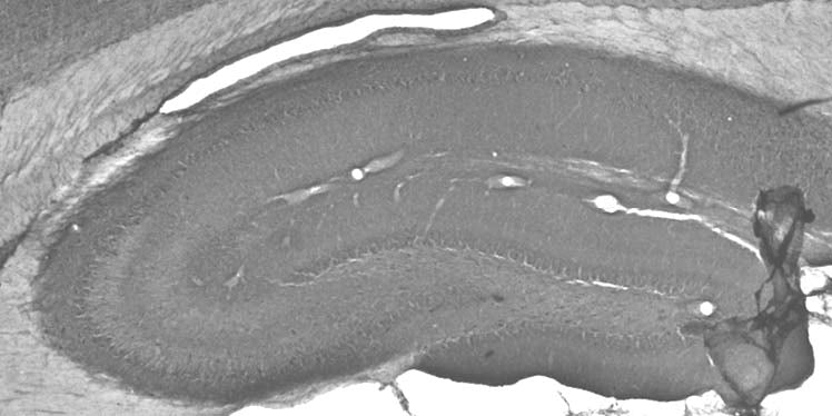 Adult rat hippocampus immunohistochemistry.
