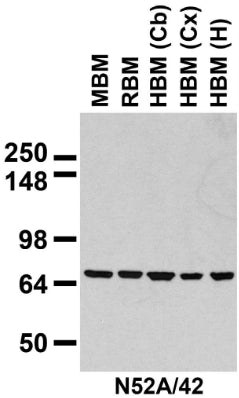 Immunoblot against crude membranes prepared from whole rat (RBM) and mouse (MBM) brain and human cerebral cortex [HBM(Cx)], cerebellum [HBM(Cb)], and hippocampus [HBM(H)] probed with N52A/42 TC supe.