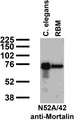 Immunoblot against crude C. elegans worm extracts and RBM probed with N52A/42 TC supe.