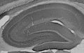 Adult rat hippocampus immunohistochemistry.