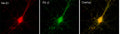 Immunofluorescence of cultured hippocampal neurons with N87/25 (red) and GABA-A-R-Gamma2 rabbit polyclonal (green). Images courtesy of Angel de Blas (University of Connecticut).