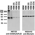 Immunoblot against membrane fractions from whole mouse (MBM) or rat (RBM) brain and from human hippocampus [HBM(H)], cerebral cortex [HBM(Cx)] or cerebellum [HBM(Cb)] and probed with N87/25 (left) or N52A/42 (right) TC supe.
