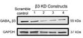 Western blot image of human BT549 cells labeling GABA-A, Beta 3 (Cat. 75-149, 1:1000). The cells were transduced with different lentiviral mediated GABAA beta 3 subunit knockdown constructs (lane 2-5). The image was