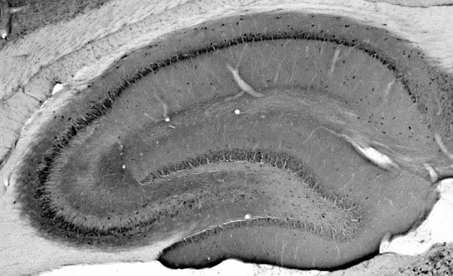 Adult rat hippocampus immunohistochemistry.