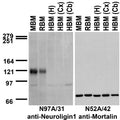 Immunoblot against crude membranes from whole mouse (MBM) or rat (RBM) brain and from human hippocampus [HBM(H)], cerebral cortex [HBM(Cx)] or cerebellum [HBM(Cb)] probed with N97A/31 (left) or N52A/42 (right) TC supe.