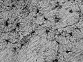 Adult rat hippocampus immunohistochemistry.