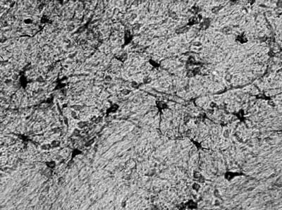 Adult rat hippocampus immunohistochemistry.