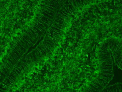 Cerebellum immunofluorescence. Images courtesy of Lynette Foo and Dr. Ben Barres, Stanford University.
