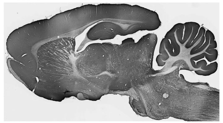 Adult rat brain immunohistochemistry.