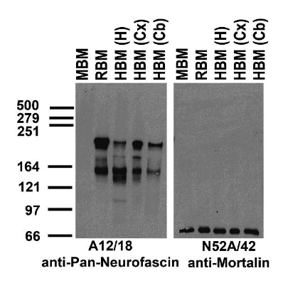 Immunoblot on crude membrane fractions from whole mouse (MBM) and rat (RBM) brain and from human hippocampus [HBM(H)], cerebral cortex [HBM(Cx)] and cerebellum [HBM(Cb)] probed with A12/18 (left) and N52A/42 (right) TC supe.