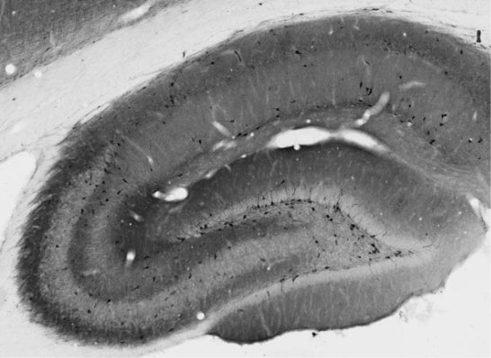Adult rat hippocampus immunohistochemistry.