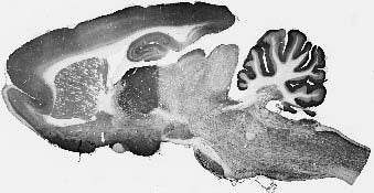 Adult rat brain immunohistochemistry.